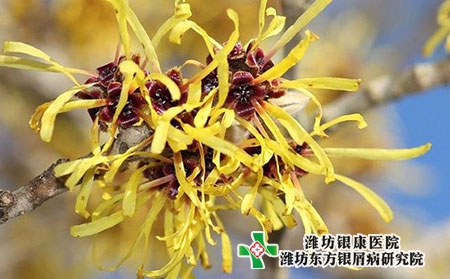 潍坊东方银屑病医院：小年来临，注意预防！