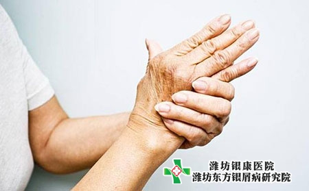 手上银屑病应该如何治疗?如何预防复发?