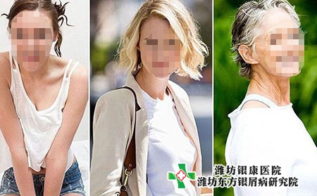 潍坊哪里看牛皮癣比较好_潍坊比较好治疗牛皮癣的医院
