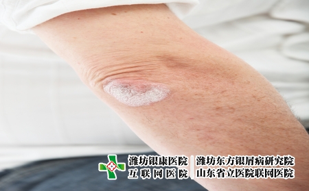 摄图网_321241037_丝虫病皮肤或决定肘肘（企业商用）