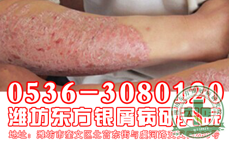 银屑病发病与患者身体缺乏哪些营养物质有关