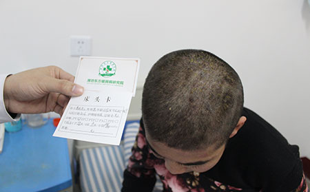 治疗儿童银屑病可以的医院
